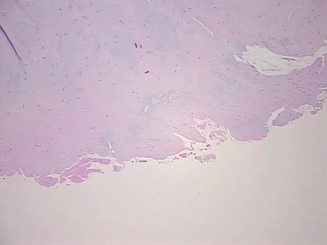 Tissue FFPE Sections, Cartilage - image 1