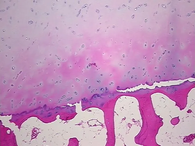 Tissue FFPE Sections, Thymus - image 1