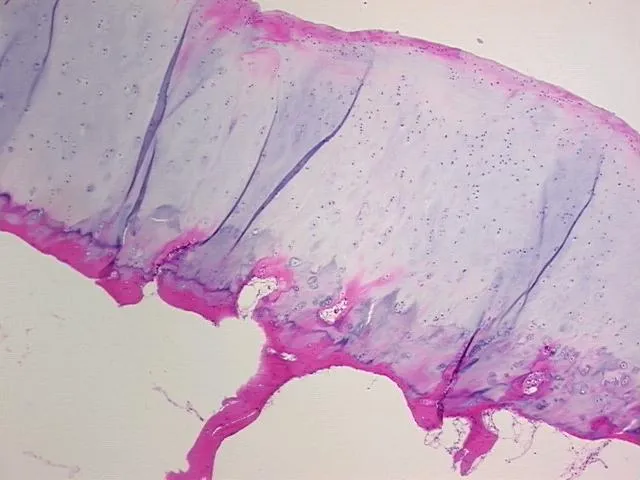 Tissue FFPE Sections, Joint - image 1