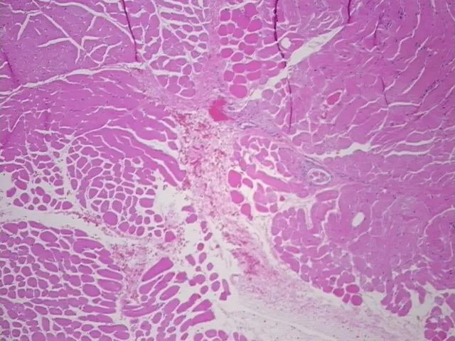 Tissue FFPE Sections, Muscle tissue - image 1