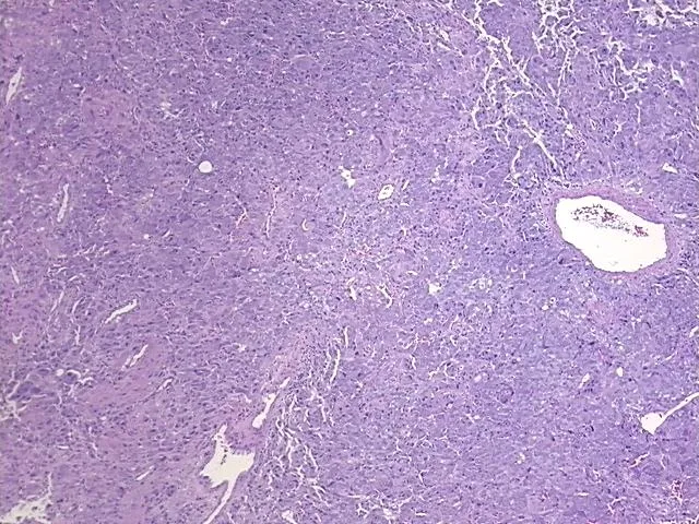 Tissue FFPE Sections, Neural tissue - image 1