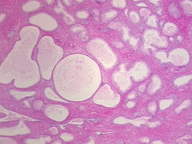 Tissue FFPE Sections, Prostate - image 1