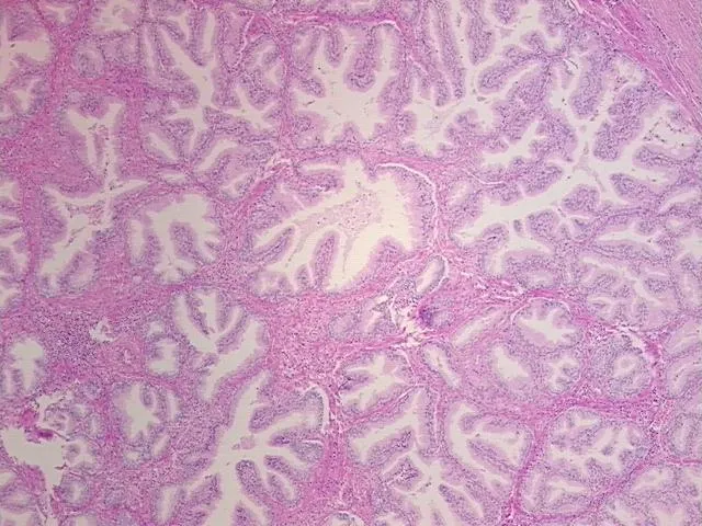 Tissue FFPE Sections, Prostate - image 1