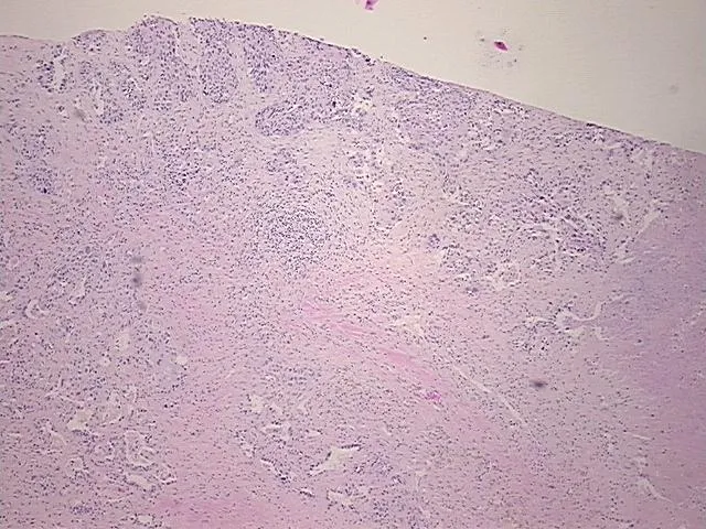 Tissue FFPE Sections, Lung - image 1