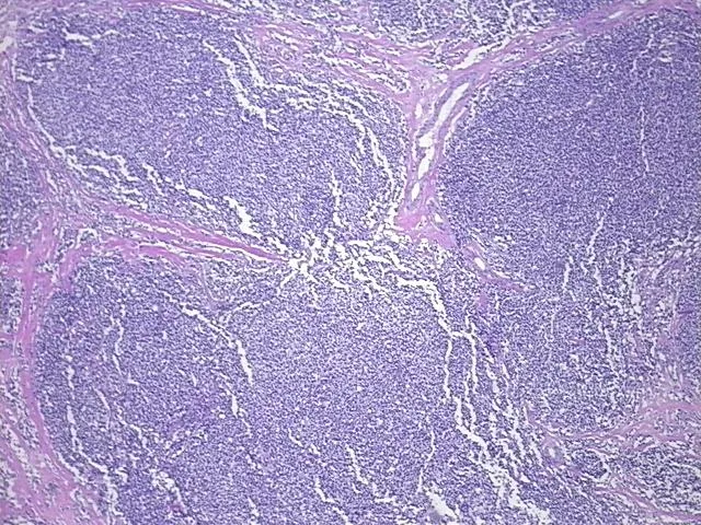 Tissue FFPE Sections, Lymphoid tissue - image 1