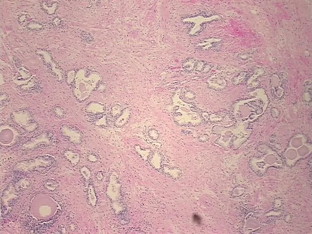 Tissue FFPE Sections, Prostate - image 1
