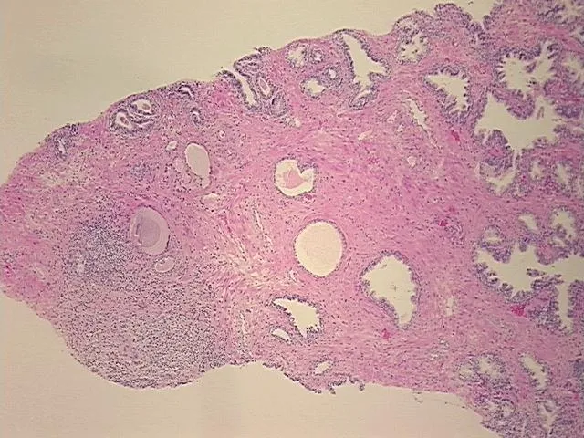 Tissue FFPE Sections, Prostate - image 1