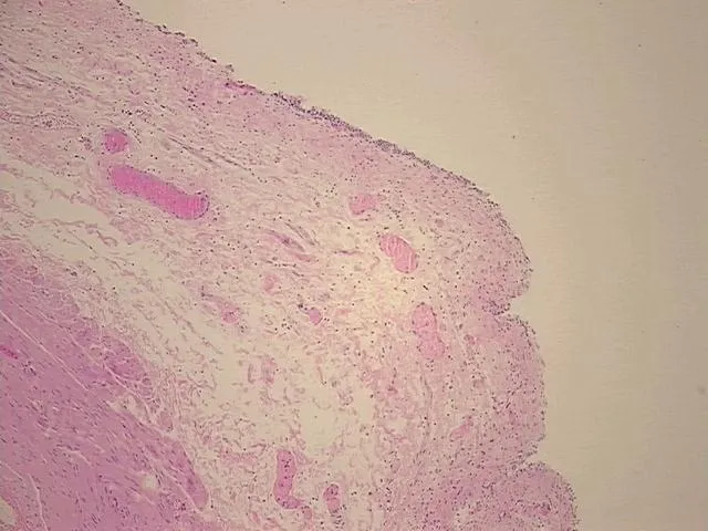 Tissue FFPE Sections, Urinary bladder - image 1