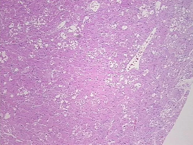 Tissue FFPE Sections, Soft tissue - image 1