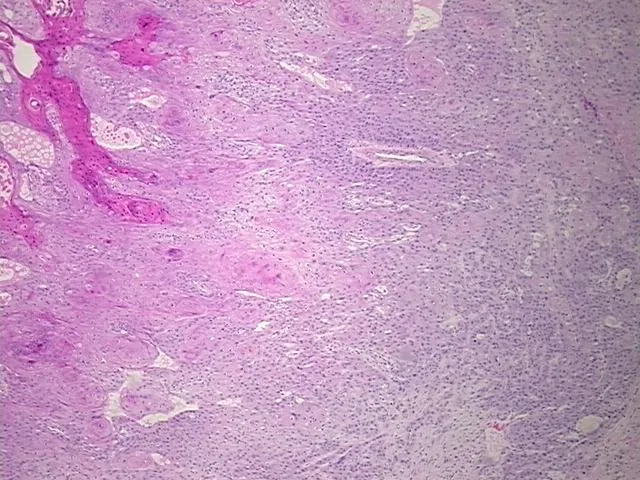 Tissue FFPE Sections, Tongue - image 1