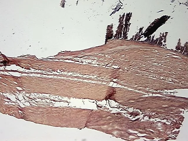 Tissue FFPE Sections, Aorta - image 1