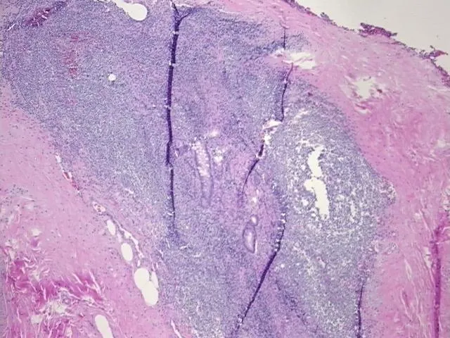 Tissue FFPE Sections, Appendix - image 1