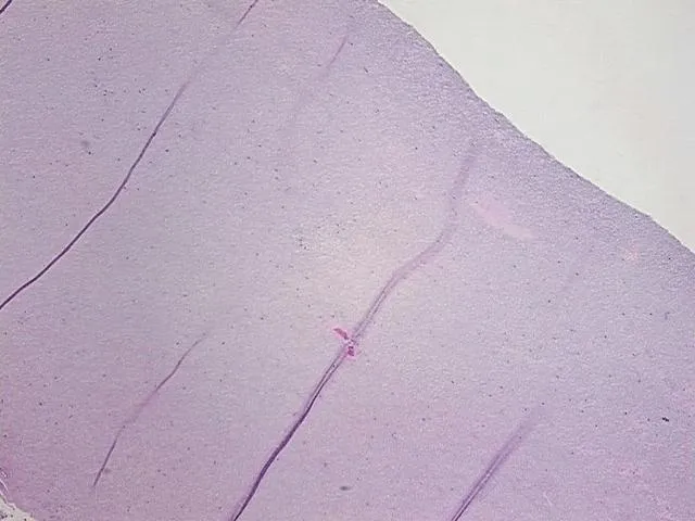 Tissue FFPE Sections, Intervertebral disc - image 1