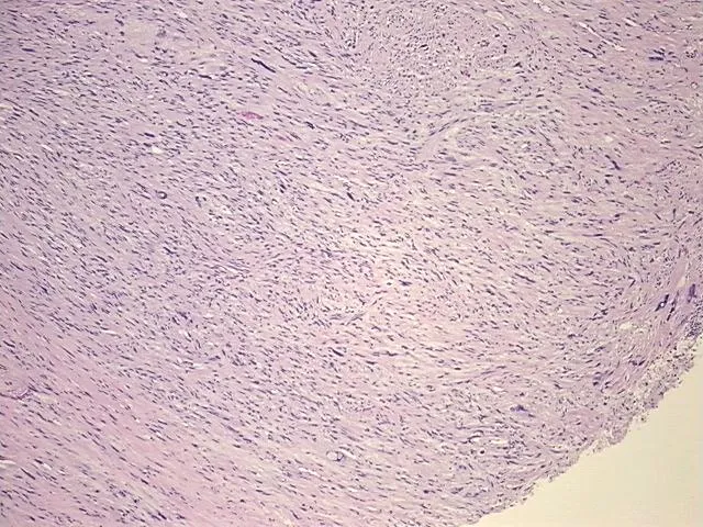 Tissue FFPE Sections, Soft tissue - image 1