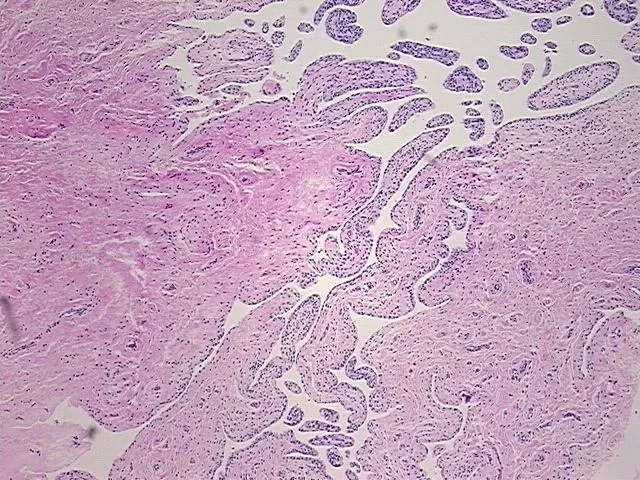 Tissue FFPE Sections, Joint - image 1