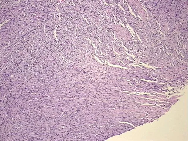 Tissue FFPE Sections, Soft tissue - image 1