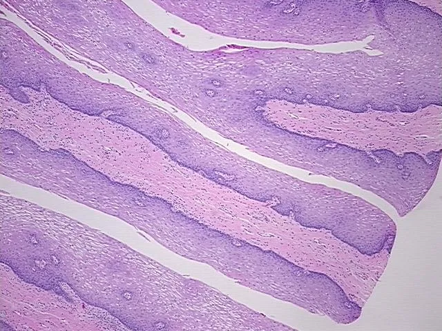 Tissue FFPE Sections, Esophagus - image 1