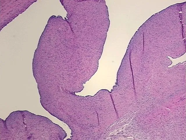 Tissue FFPE Sections, Ovary - image 1