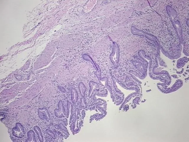 Tissue FFPE Sections, Gallbladder - image 1