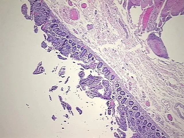 Tissue FFPE Sections, Jejunum - image 1