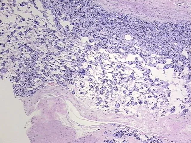 Tissue FFPE Sections, Neural tissue - image 1