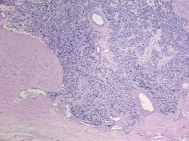 Tissue FFPE Sections, Neural tissue - image 1
