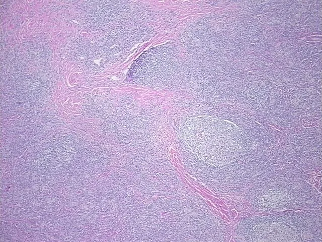 Tissue FFPE Sections, Lymphoid tissue - image 1