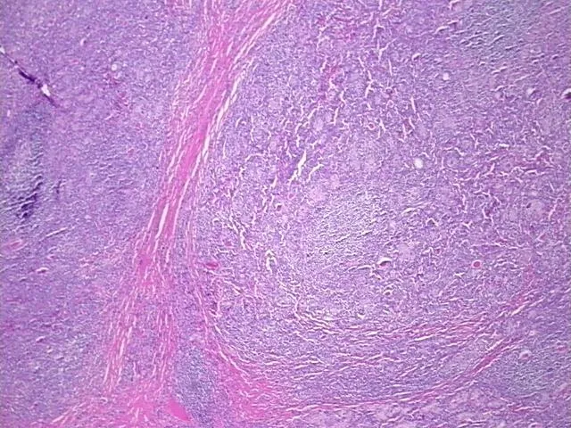 Tissue FFPE Sections, Lymphoid tissue - image 1