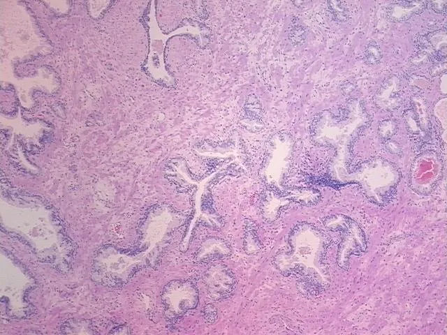Tissue FFPE Sections, Prostate - image 1