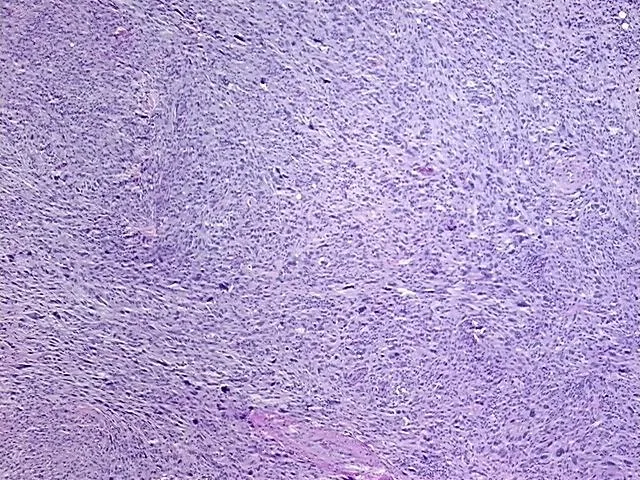 Tissue FFPE Sections, Soft tissue - image 1