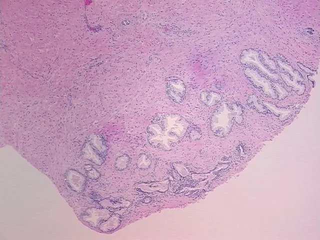 Tissue FFPE Sections, Prostate - image 1