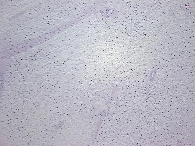 Tissue FFPE Sections, Soft tissue - image 1