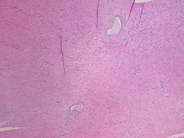 Tissue FFPE Sections, Rectum - image 1