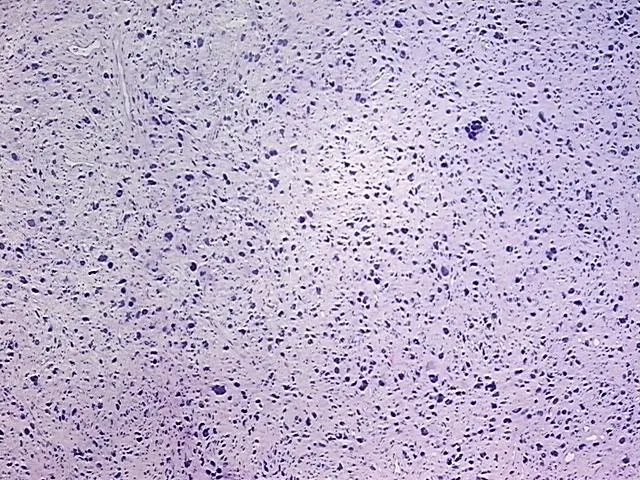 Tissue FFPE Sections, Soft tissue - image 1