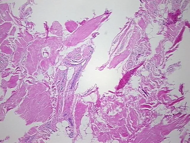 Tissue FFPE Sections, Knee - image 1