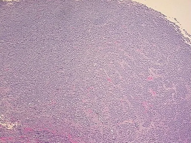 Tissue FFPE Sections, Pituitary gland - image 1