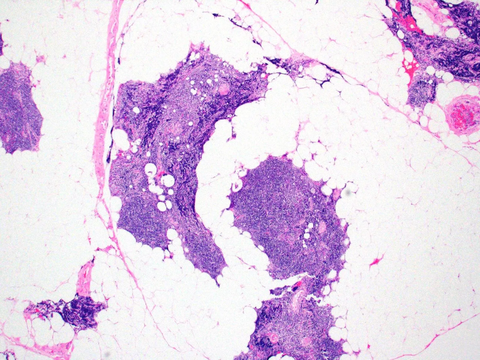 Tissue FFPE Sections, Thymus - image 1