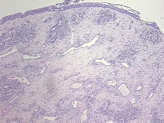 Tissue FFPE Sections, Nose - image 1