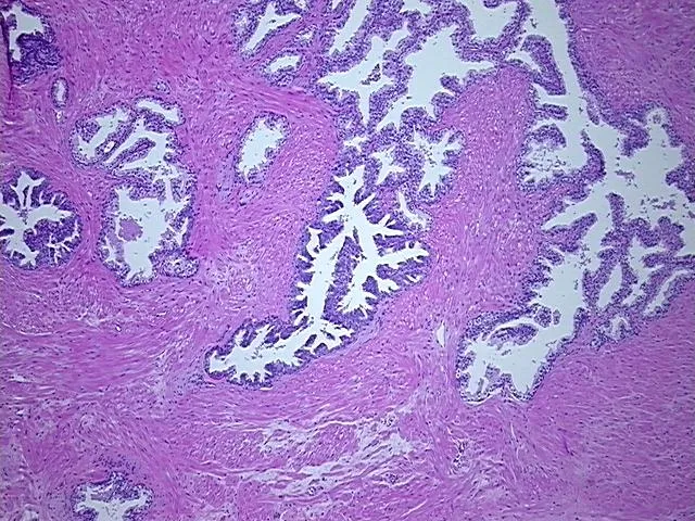 Tissue FFPE Sections, Prostate - image 1