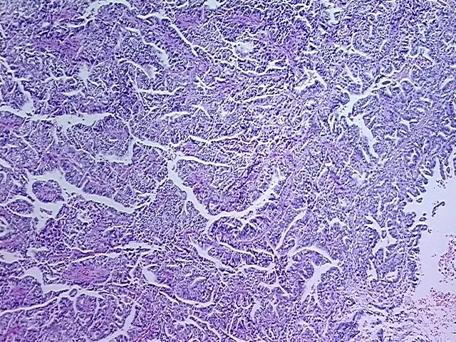 Tissue FFPE Sections, Gallbladder - image 1