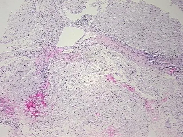 Tissue FFPE Sections, Neural tissue - image 1