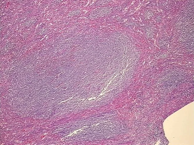 Tissue FFPE Sections, Lymphoid tissue - image 1