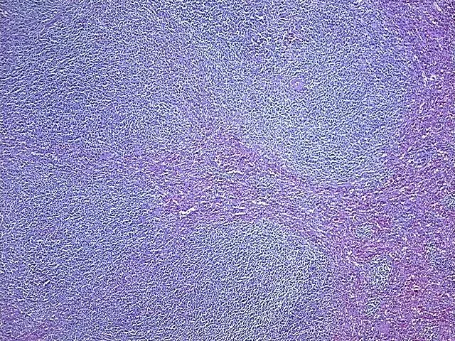 Tissue FFPE Sections, Lymphoid tissue - image 1