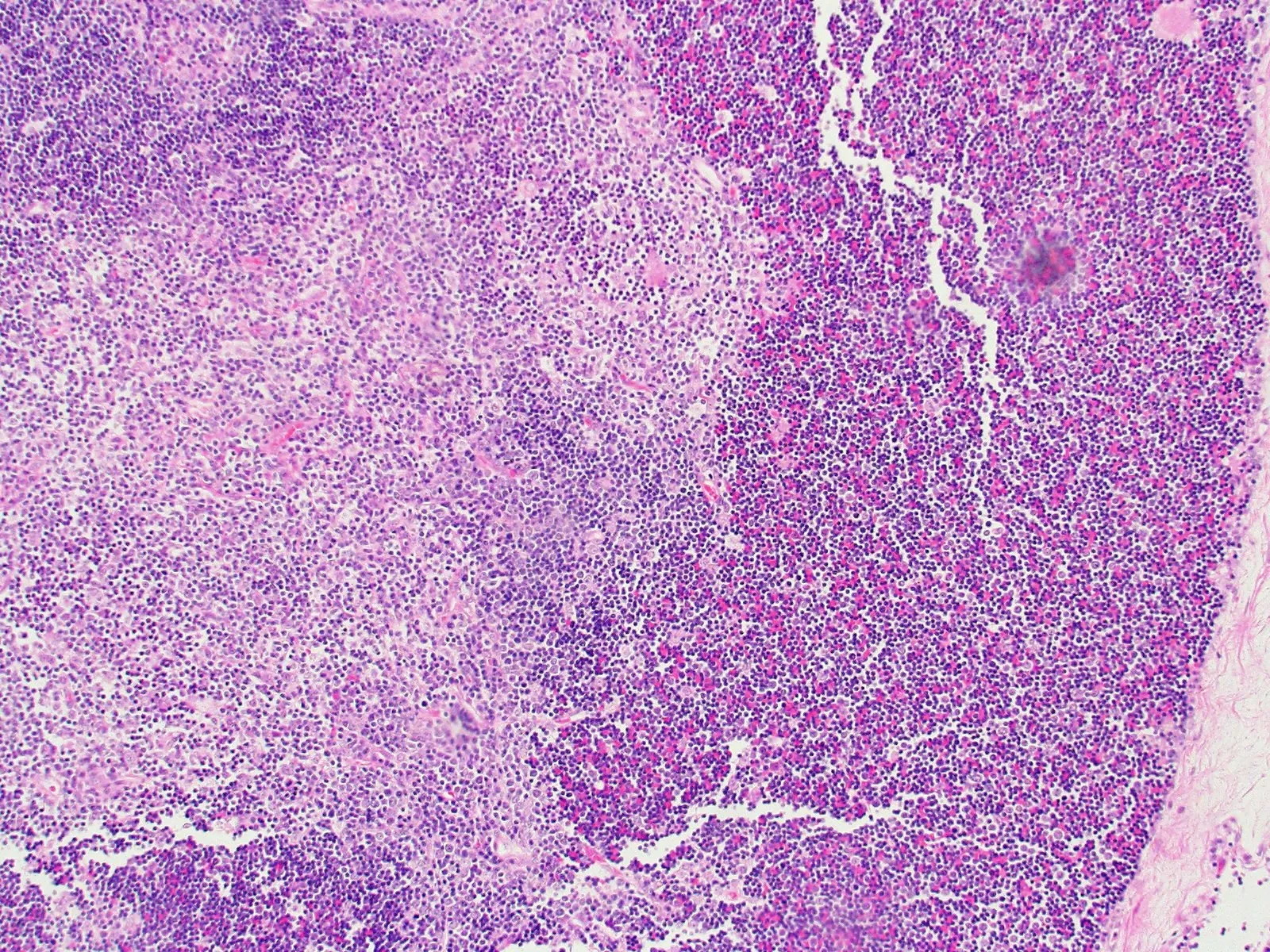 Tissue FFPE Sections, Thymus - image 1