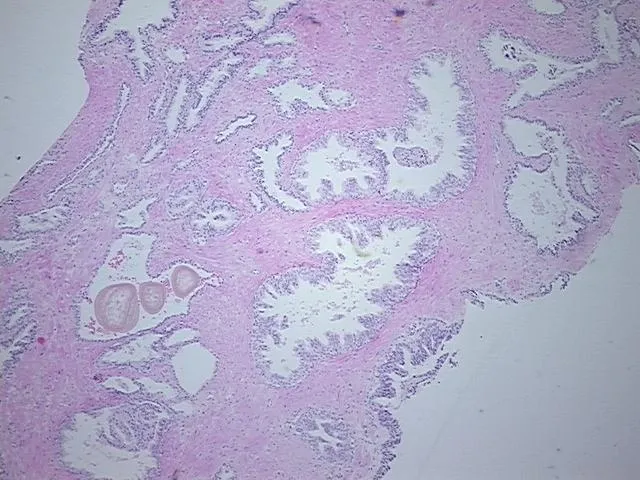 Tissue FFPE Sections, Prostate - image 1