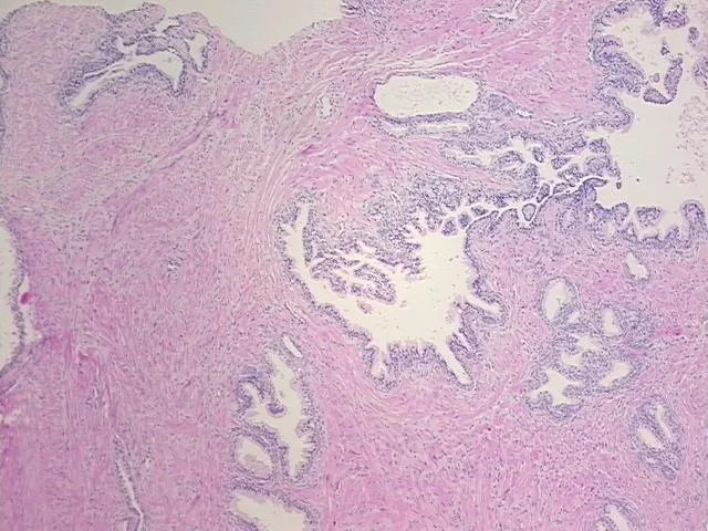 Tissue FFPE Sections, Prostate - image 1