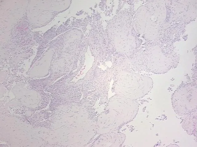 Tissue FFPE Sections, Brain - image 1