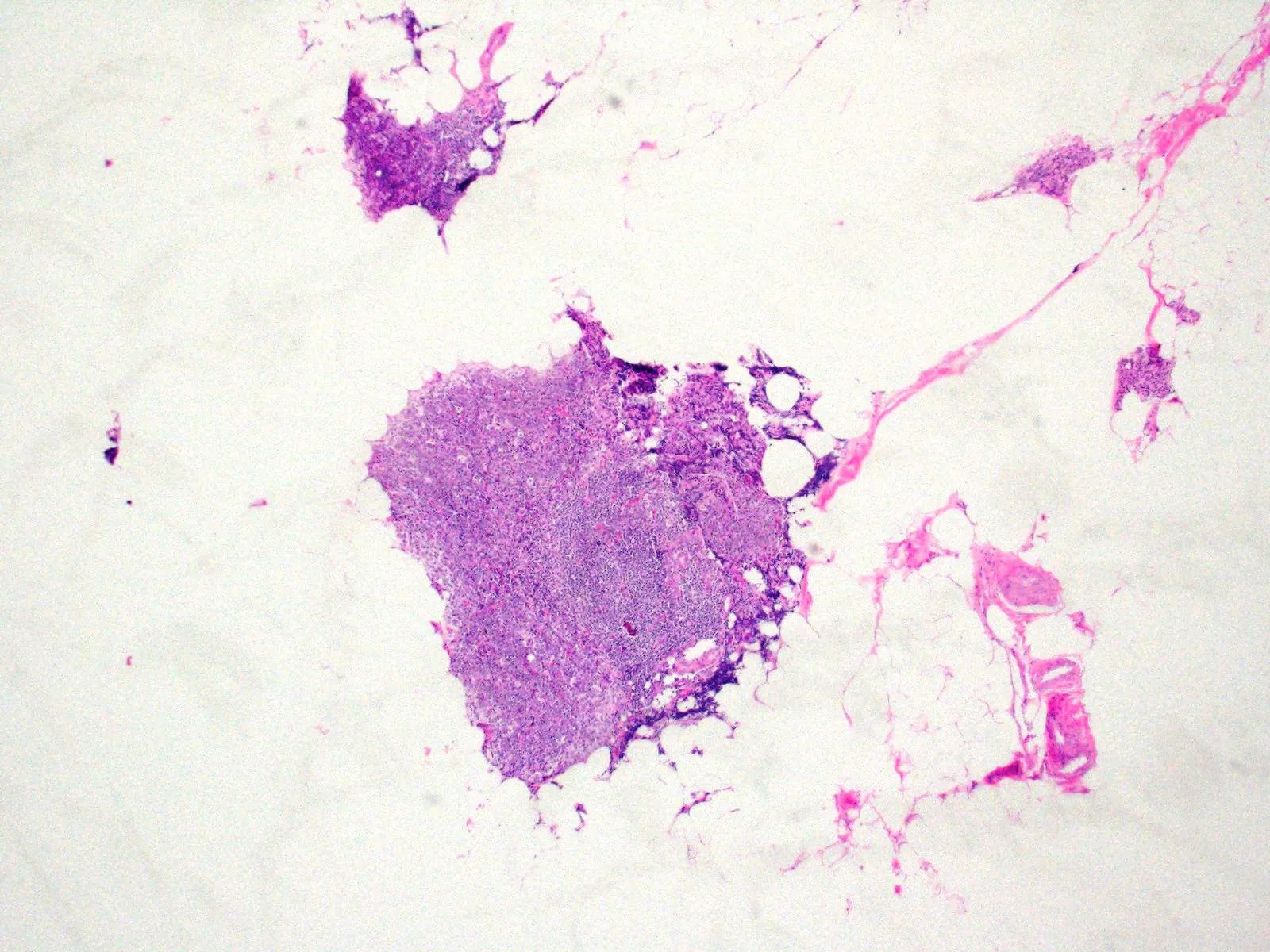 Tissue FFPE Sections, Thymus - image 1