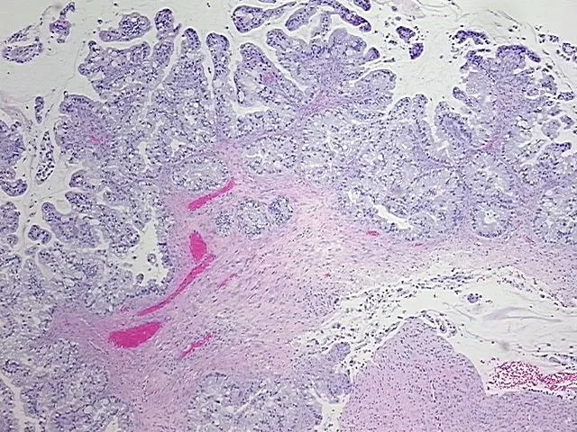 Tissue FFPE Sections, Gallbladder - image 1