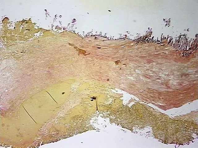 Tissue FFPE Sections, Aorta - image 1